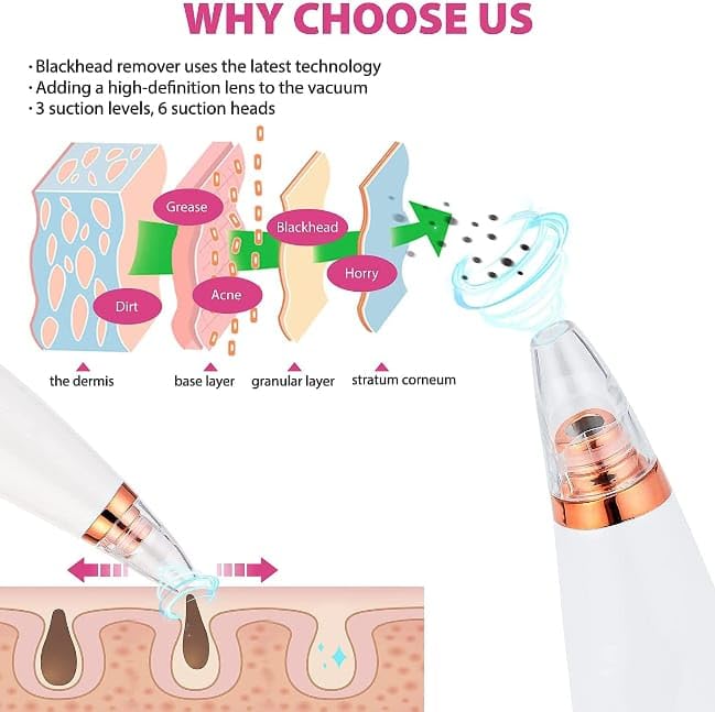 Blackhead Remover Vacuum Tool — 6 in 1 Electric Pore Cleanser